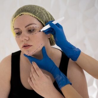 Spider Veins On Face Treatment In Dubai