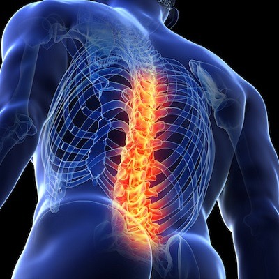 Spinal Cord Injuries in Dubai, Abu Dhabi & Sharjah Price & Cost