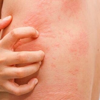 Latest Advances In Skin Diseases Treatment in Dubai