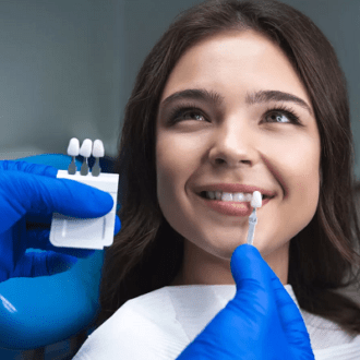 What Happens When Veneers Fall Off in Dubai