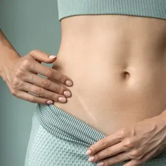 Artful Recovery: The Aesthetics Of Scar Camouflage