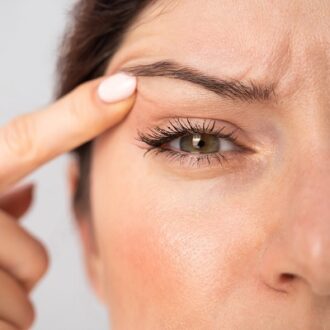 Upper Eyelid Filler Dubai & Abu Dhabi