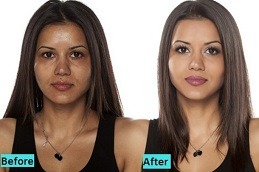 Best clinic of Glutathione Injections In Dubai