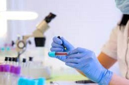 Blood Test For Liver Function at Home in Dubai