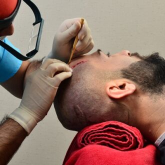 Dubai’s No. 1 Hair Transplant Clinic