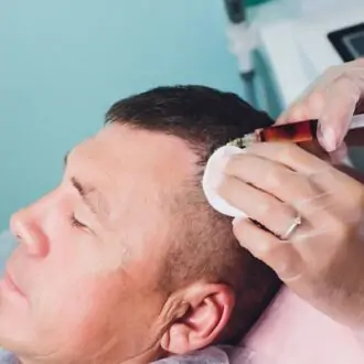 Exploring The Benefits Of Exosomes For Hair Loss