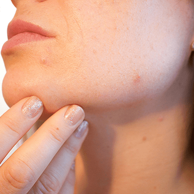 Facial Rejuvenation Techniques A Professional Perspective in Dubai
