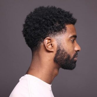 Hair Restoration For Black Males in Dubai