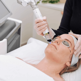 PICO Laser For Pigmentation in Dubai & Abu Dhabi