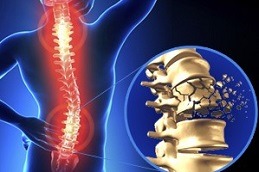 Spinal Cord Injuries in Dubai