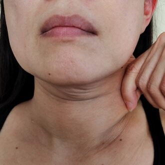 The Pros and Cons of Double Chin Removal in Dubai