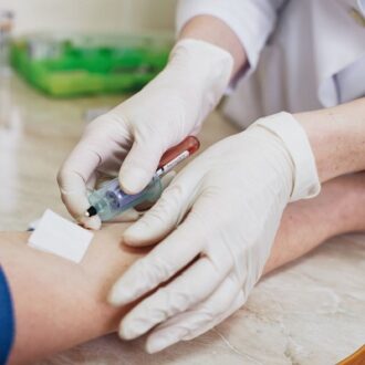 Vitamin D Test At Home Cost in Dubai & Abu Dhabi