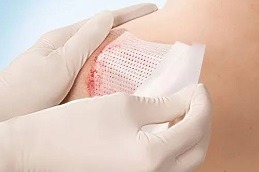 Wound Dressing in Dubai