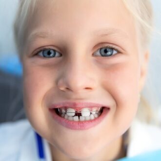 Can You Get Braces On Only Your First Teeth?