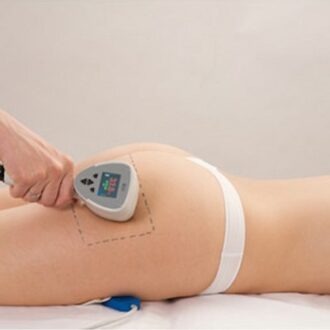 Exilis Treatment: What You Need To Know in Dubai