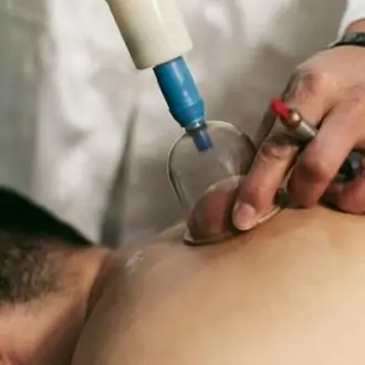 Hijama Home Service Dubai & Abu Dhabi