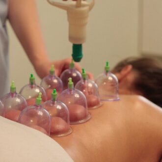 Hijama Treatment Cost In Dubai | Hijama Dubai