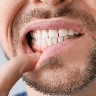 Is Teeth Whitening Is Painful In Dubai & Abu Dhabi