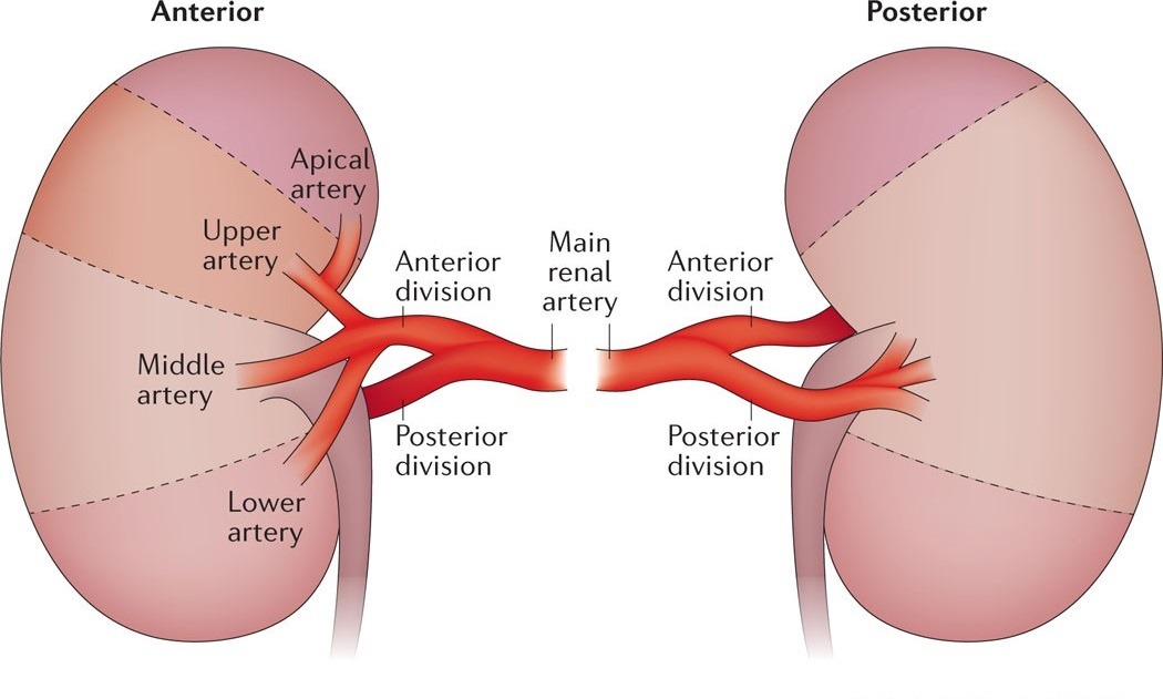 Simple Nephrectomy infographic in Dubai