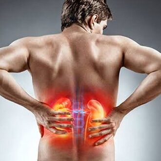 Surgical Kidney Stone Removal Cost in Dubai