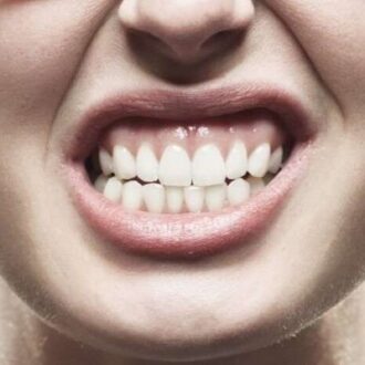 Teeth Grinding Treatment Cost In Dubai