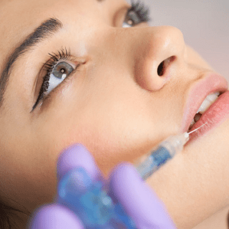 Lip Augmentation: Types, Side Effects, Risks