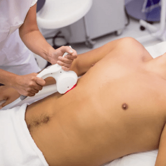 Male Intimate Laser Hair Removal in Dubai