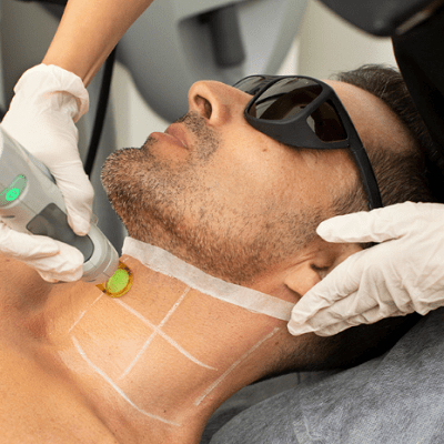 The Do’s And Don’ts Of Preparing For Laser Hair Removal