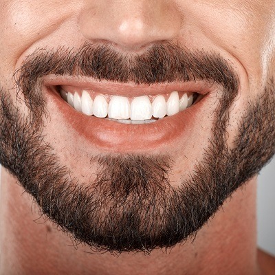 Teeth Whitening At Enfield Royal Clinic In Dubai