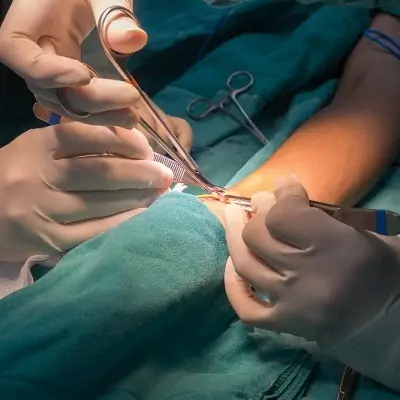 Fistula Surgery in Dubai & Abu Dhabi Enfield Royal Clinic