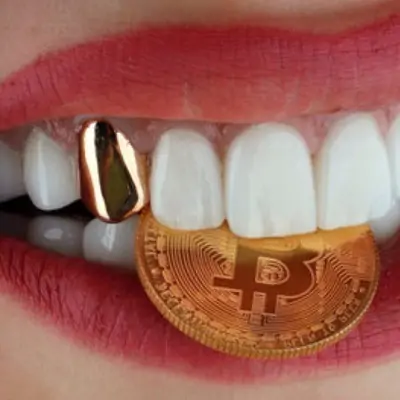 Gold Teeth In Dubai Royal Clinic