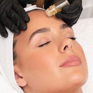 Transformative Benefits Of AquaGold Fine Touch Facial