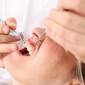 Best Deep Scaling And Polishing In Dubai