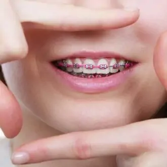 Can Braces Change Your Jawline?