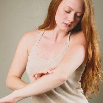 Do Stretch Marks Go Away When You Lose Weight