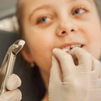 Teeth Extraction Cost In Dubai