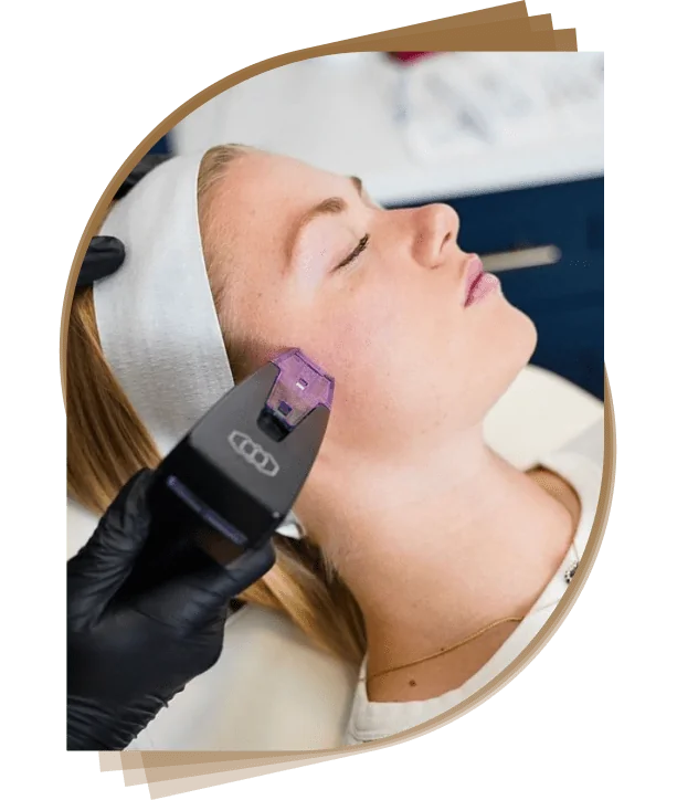 Best Morpheus 8 treatment