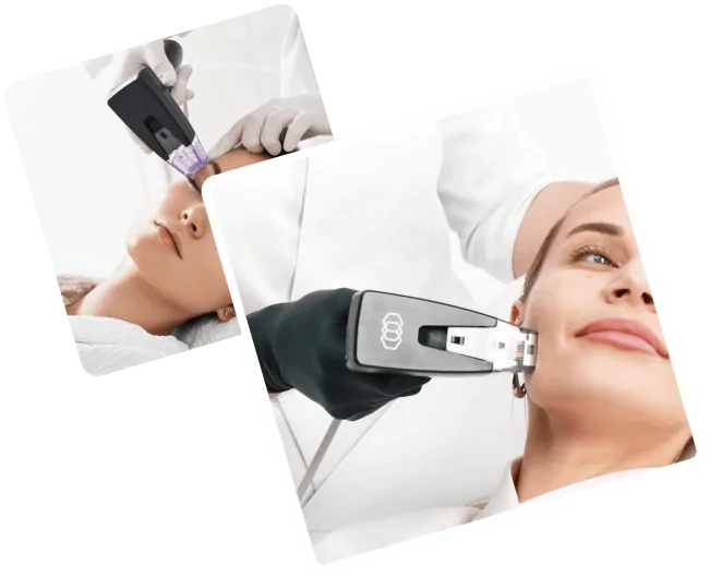 Best Morpheus 8 treatment in Dubai