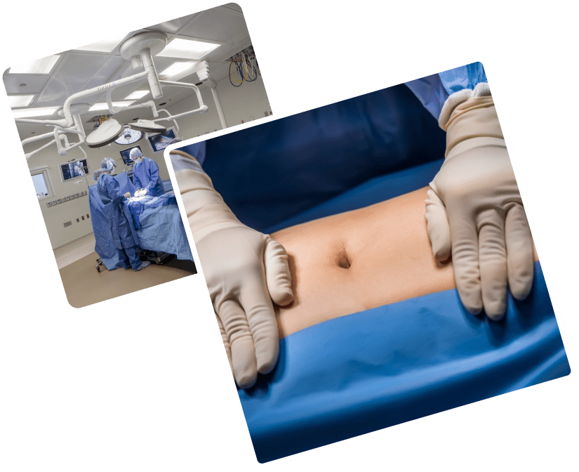 Best Liposuction Surgery Clinic in Dubai​ UAE