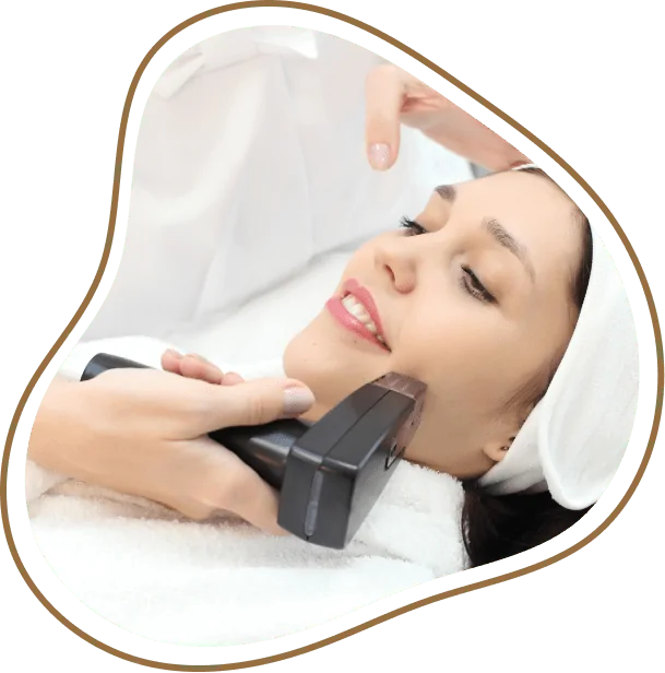 Morpheus 8 Treatment