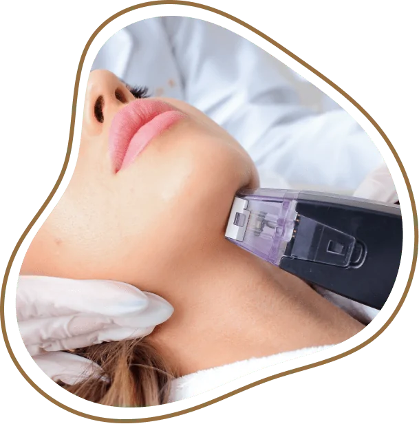 Morpheus 8 Treatment in Dubai