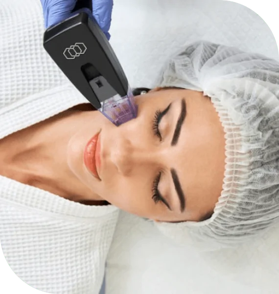 Morpheus 8 treatment in Dubai