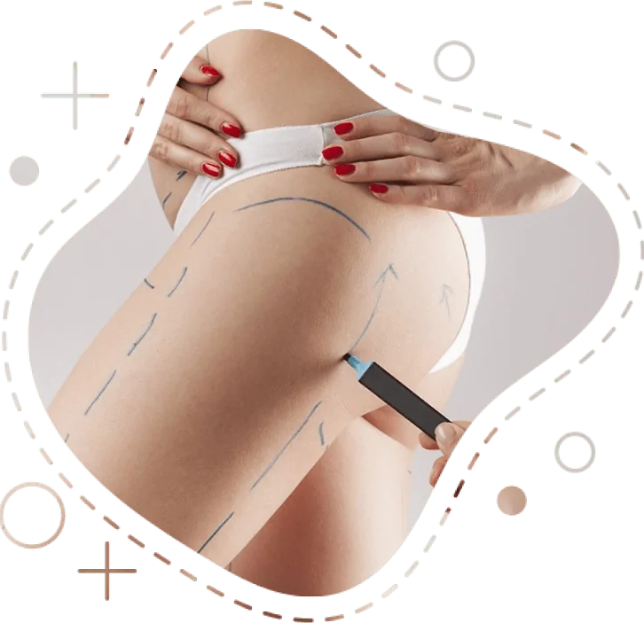 Best Liposuction in Dubai​