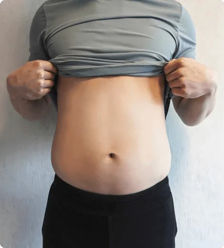 Liposuction Surgery UAE