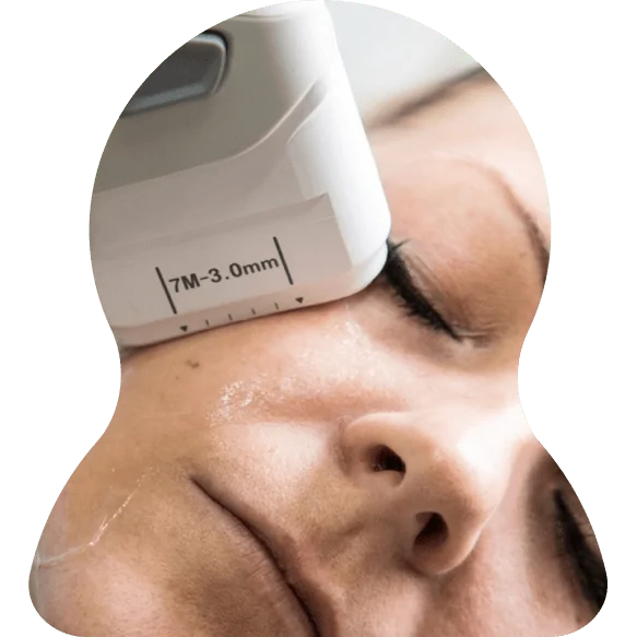 HIFU Treatment Dubai