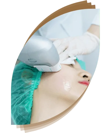 hifu treatment in dubai