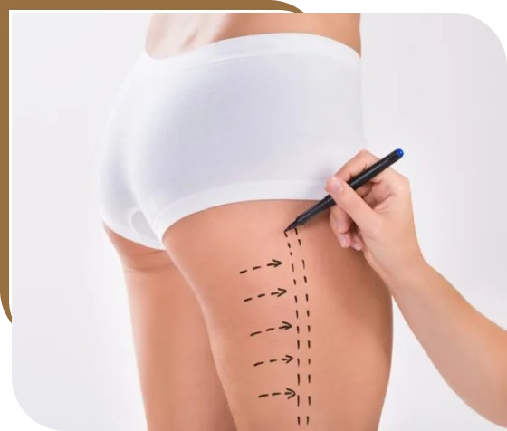 Thigh Lift treatment Dubai