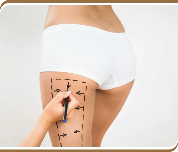 Thigh Lift in Dubai