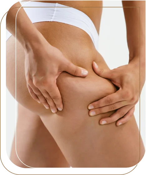 Thigh Lift