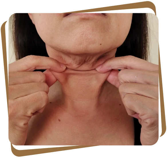 skin tightening Dubai